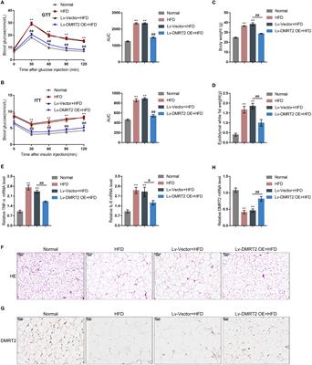 DMRT2 Interacts With FXR and Improves Insulin Resistance in Adipocytes and a Mouse Model